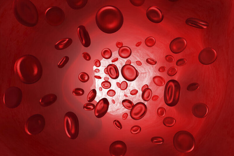 Therapeutic Plasma Exchange