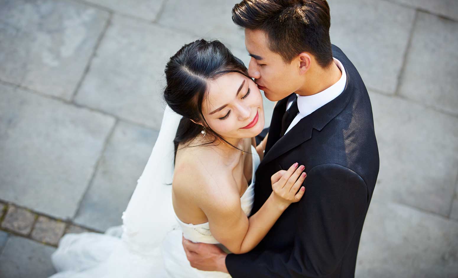 Underarm Sweating (Hyperhidrosis)